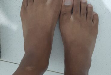 Pés masculinos